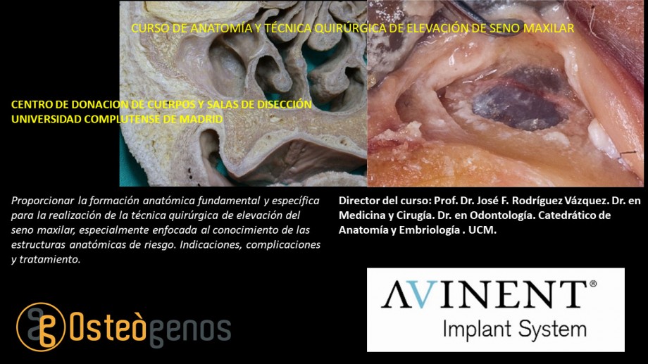 anatomia del seno maxilar